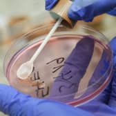 A person in the UK has died in an E.coli outbreak. (Photo: Sean Gallup/Getty Images)