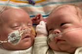 Harley and Harry Crane were given zero per cent chance of survival when they were born at 22 weeks and five days