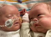 Harley and Harry Crane were given zero per cent chance of survival when they were born at 22 weeks and five days