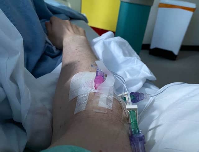 IV fluids in Michael's arm