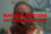 A mum was left ‘unrecognisable’ after attack 