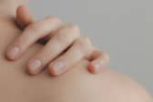 Could you tell the difference between a harmless rash from a fatal illness? (Photo: Pexel, Ximena Mora)