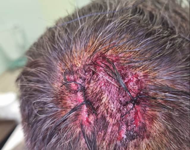 PC Ashley Aspinall with the serious head wound sustained while on duty in Blackpool