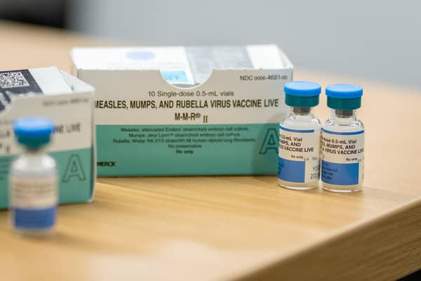 Measles is a highly contagious viral infection, which can have serious health consequences.