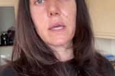 A bride-to-be on the quest to look picture perfect on her big day had surgery to remove saggy skin from her EYELIDS costing £1.1k and says it was "worth every penny" 